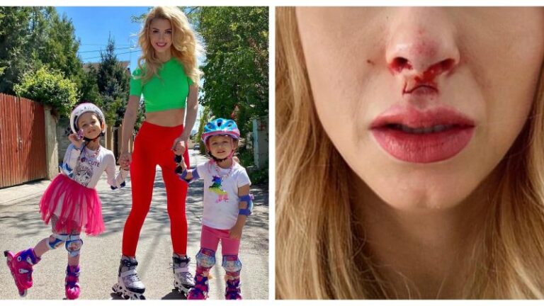 Andreea Balan a cazut si s-a lovit cu fata de bordura: „Mi-a cusut buza de sus”